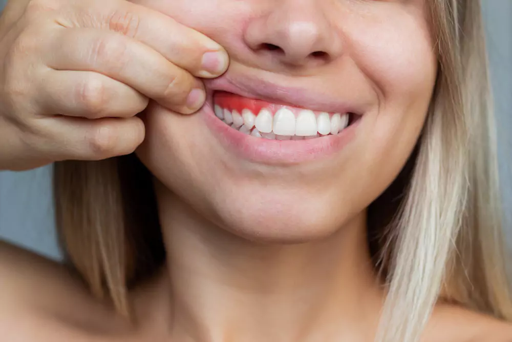 Gum Treatment